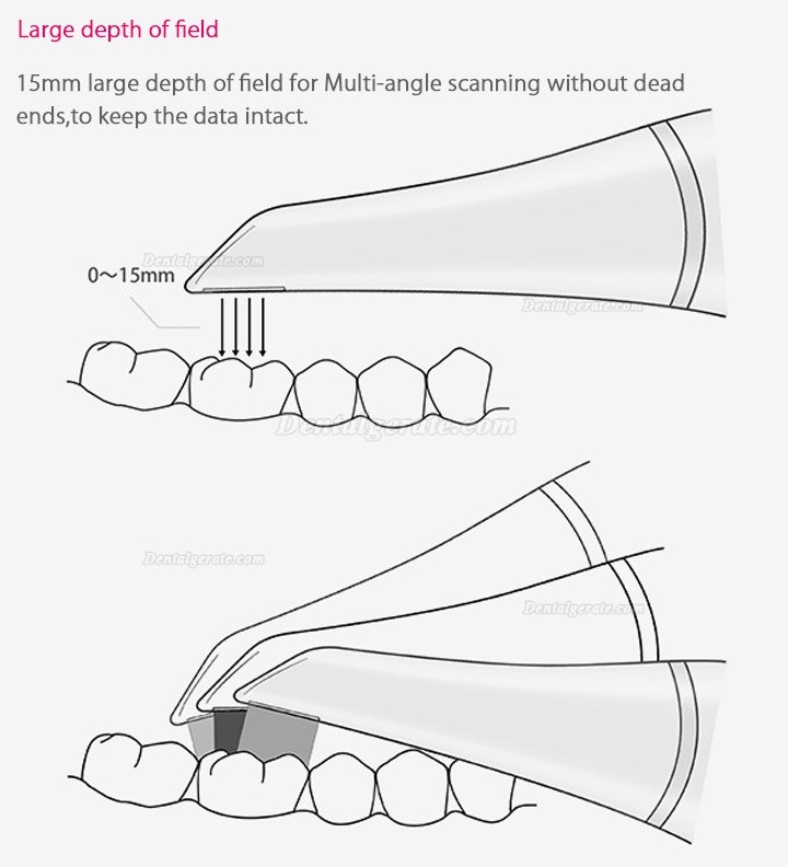 Fussen Dental 3D Digitaler Intraoralscanner